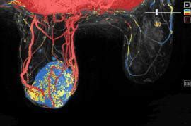 weill cornell radiology|weill cornell imaging mammogram.